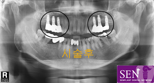 전석근~4