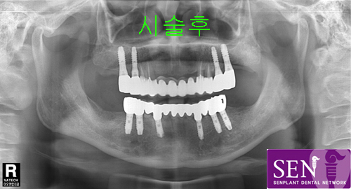 지순철~1