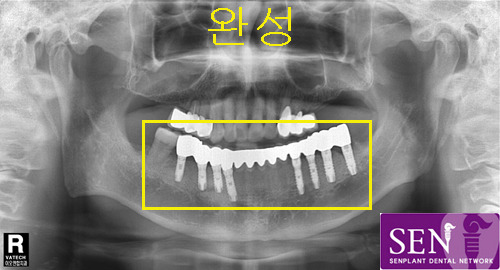 박113D~1