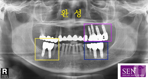 완성_1~1