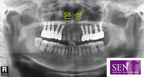 이차영-완성