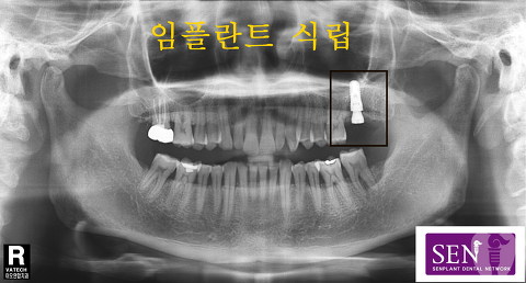 파노-~1