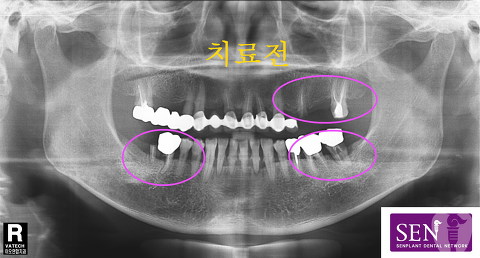 파노-~1