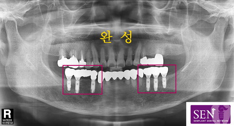 파노-~1