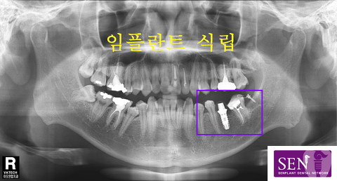 파노-~1