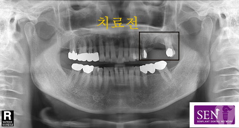 파노-~3