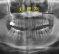 파노-~3