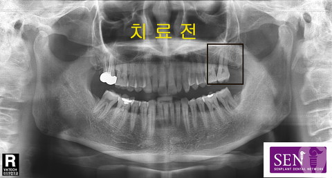 파노-~3