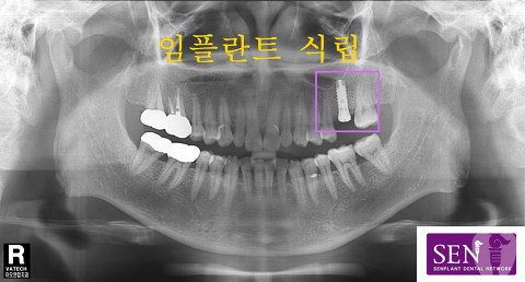 파노-~3