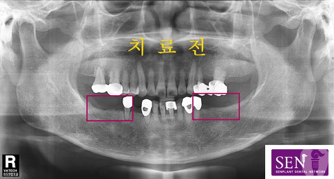 파노-~3