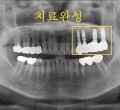 파노-~4