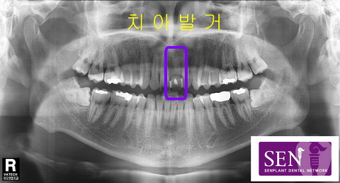 파노-대기중