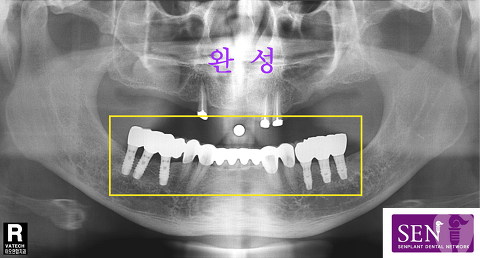 파노-완료