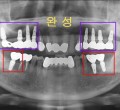 파노-완료