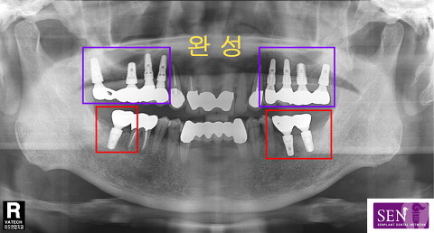 파노-완료