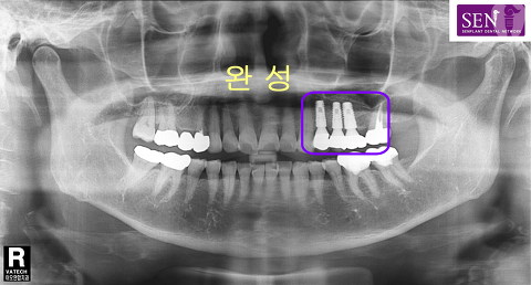 파노-완료