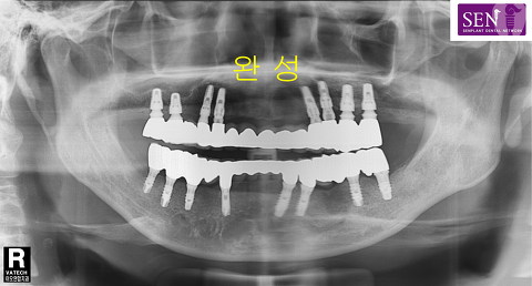 파노-완성