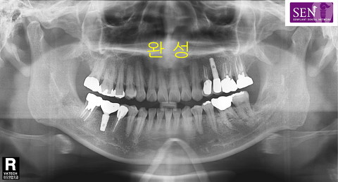 파노-완성