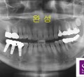 파노-완성