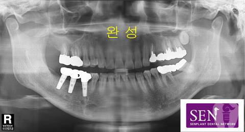 파노-완성