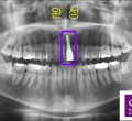 파노-완성