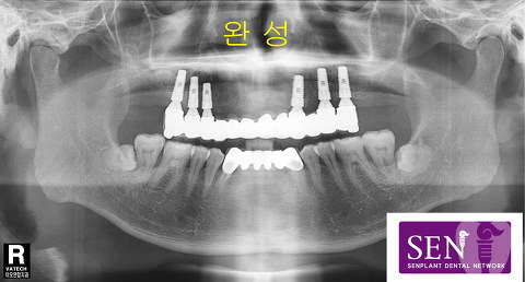 파노-완성