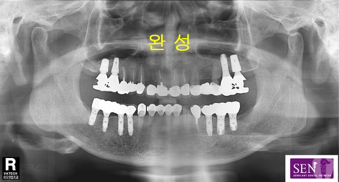 파노-완성