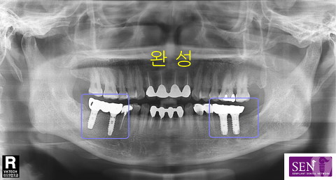 파노-완성