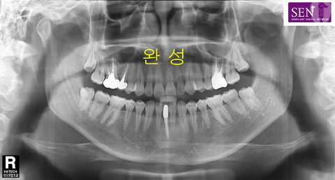 파노-완성