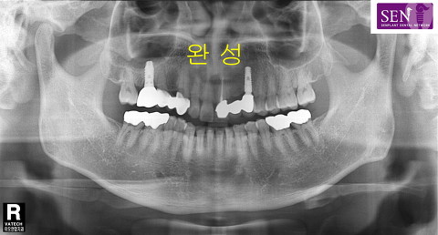 파노-완성