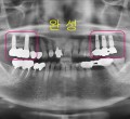 파노라마-완성