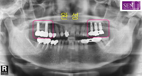 파노라마-완성