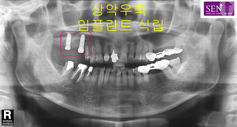 파노라마-우측