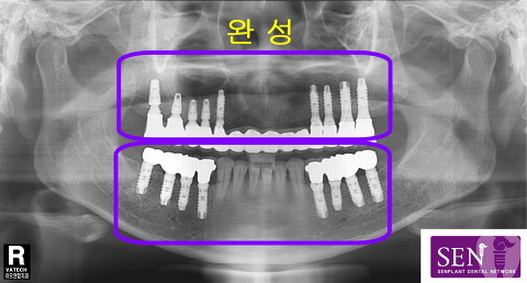 완성