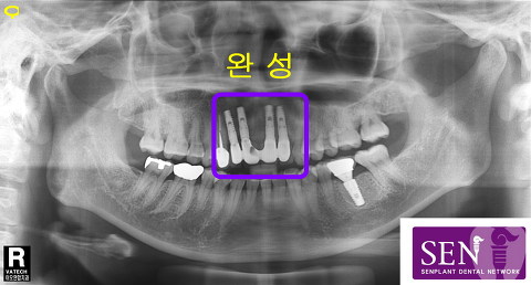 완성