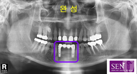 완성