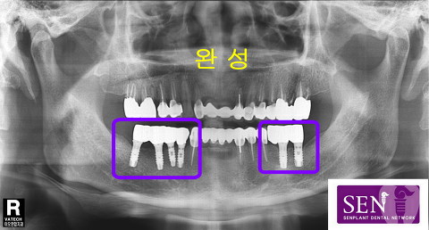 완성