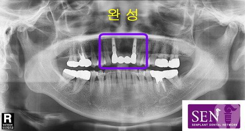 완성