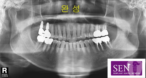 파노-완성