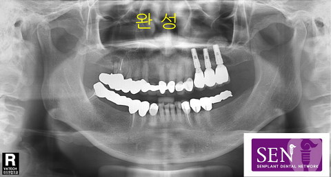 파노-완성